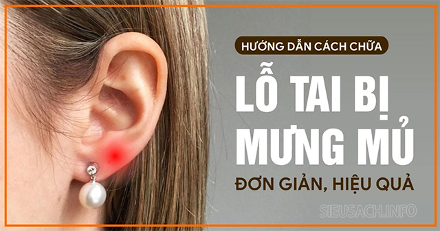 Cách chữa bấm lỗ tai bị mưng mủ