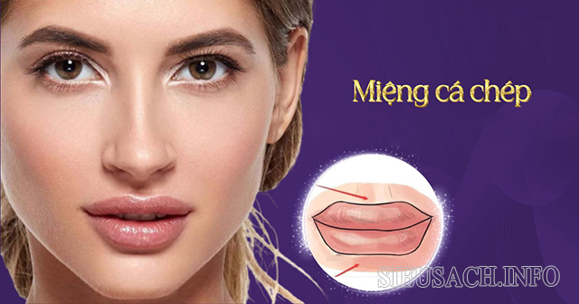 Tướng miệng cá chép là một trong những tướng phụ nữ hồng nhan bạc mệnh