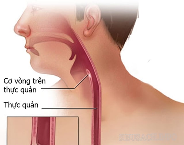 Thực quản là một bộ phận của hệ tiêu hóa giúp ngăn không cho thức ăn trào ngược lên