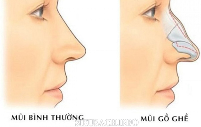 Tướng mũi kẻ tiểu nhân gồ ghề, cong vẹo