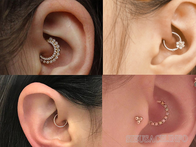 Vị trí bấm lỗ tai Daith