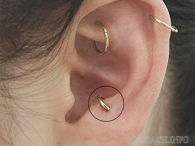 Vị trí xỏ lỗ tai Anti-tragus Piercing