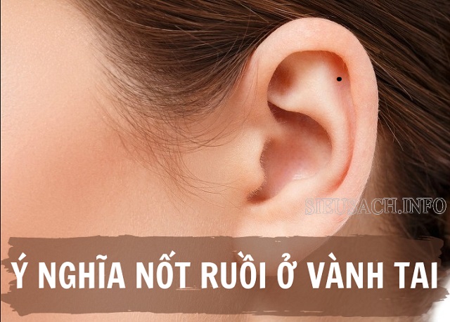 Ý nghĩa nốt ruồi ở vành tai